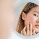 exosomes treatment Dr. Belinda Capera Natural Beauty Clinic