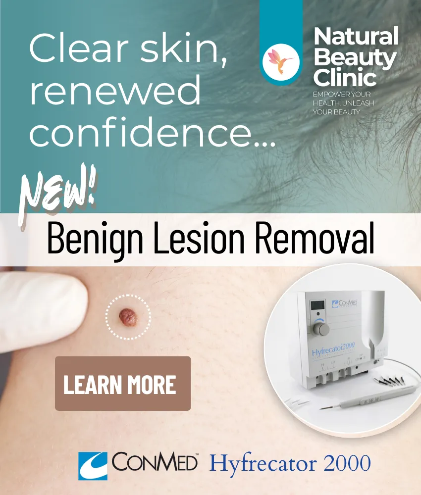 Benign Lesion Removal with High Frequency