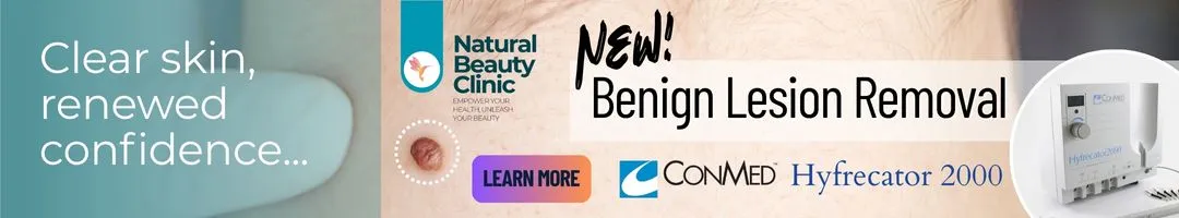 Benign Lesion Removal with High Frequency