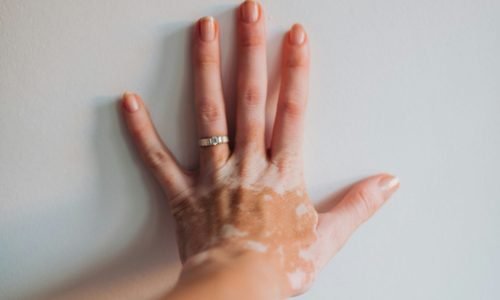 inna-kapturevska_ua–PsQMuZZOSo-unsplash inna-kapturevska_ua--PsQMuZZOSo-unsplash